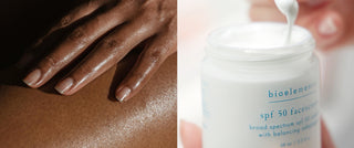 The ultimate guide to understand and prevent sun damage (beyond summer)