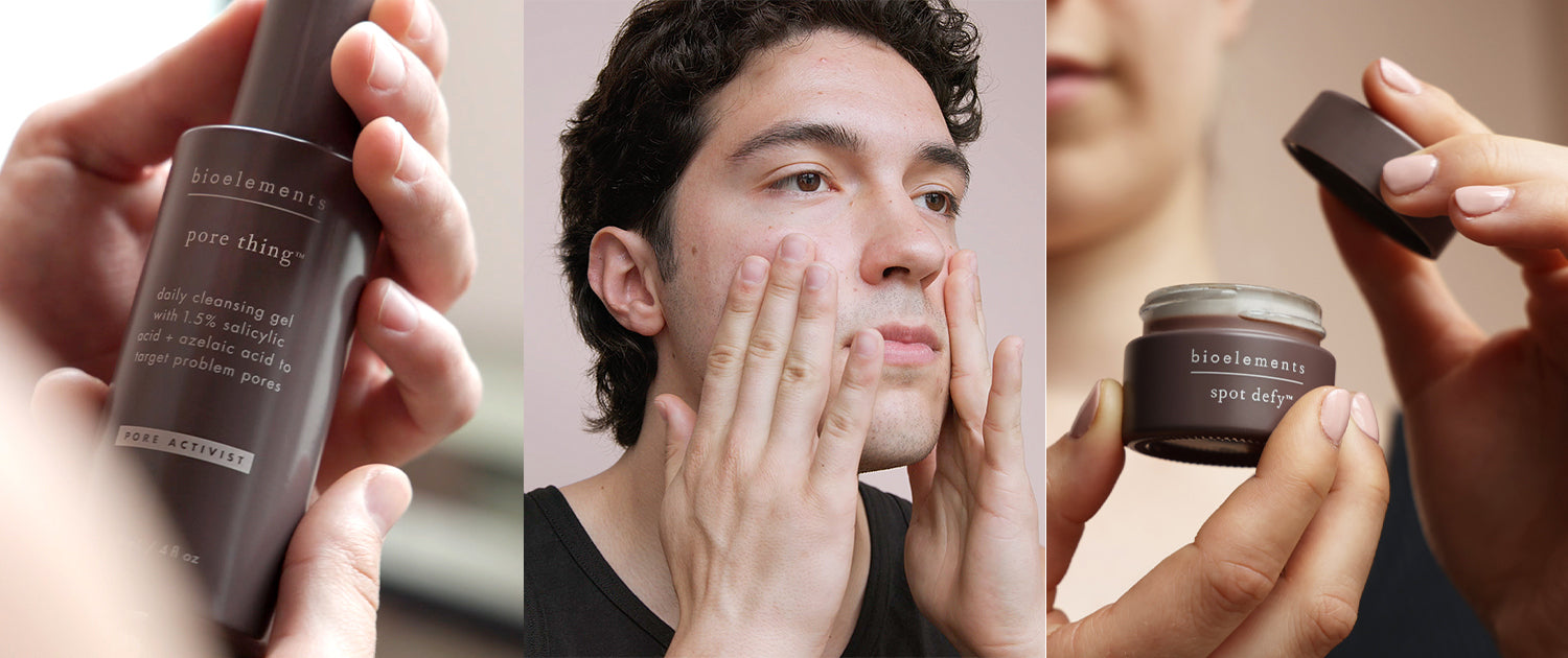 3 reasons to ditch your old-school acne formulas – Bioelements